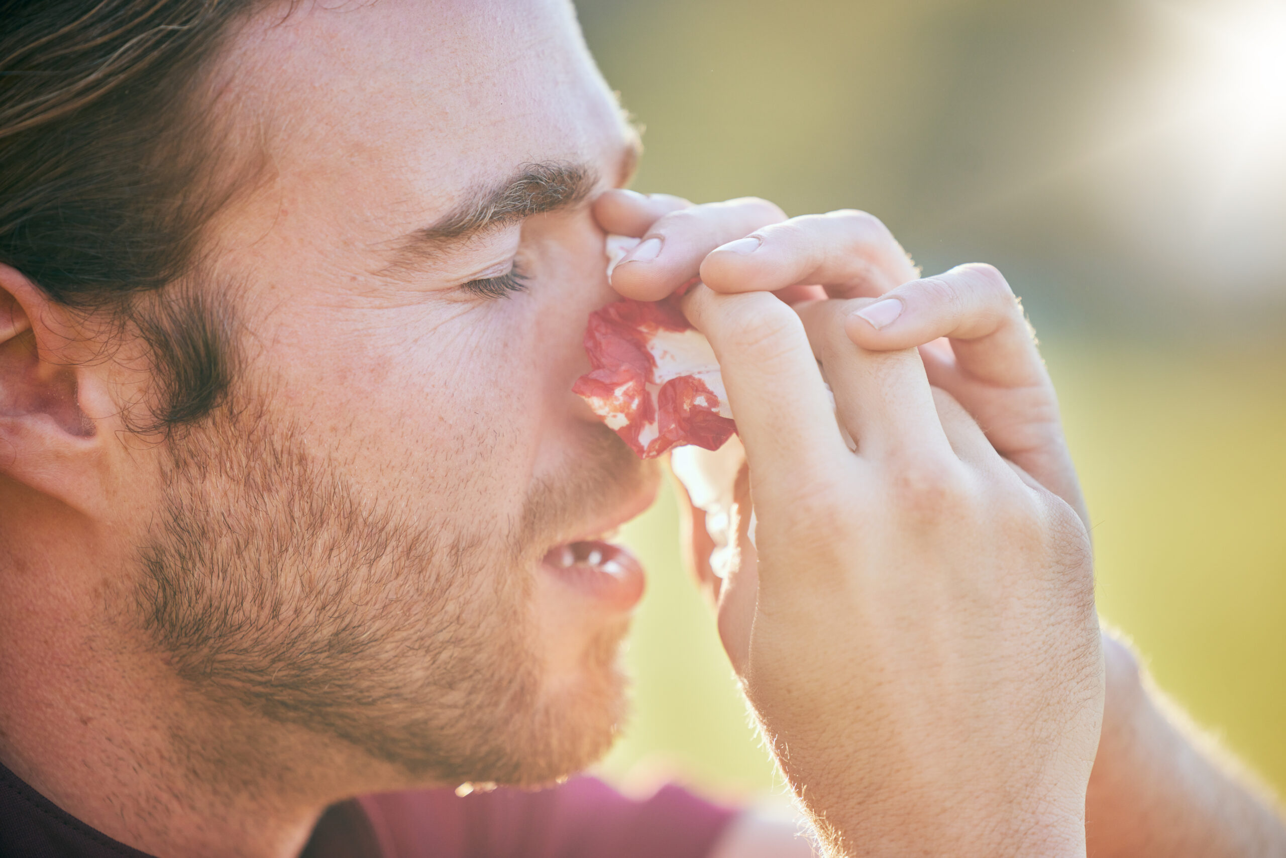 nose-bleed-man-and-injury-closeup-on-sport-field-2023-11-27-05-32-25-utc